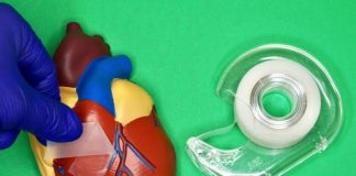 쉽게 떼어내는 내부장기 수술 봉합 테이프